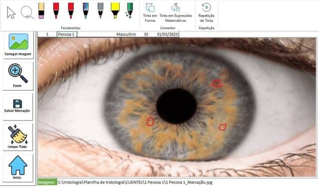 Sistema Iridologia Excel 3
