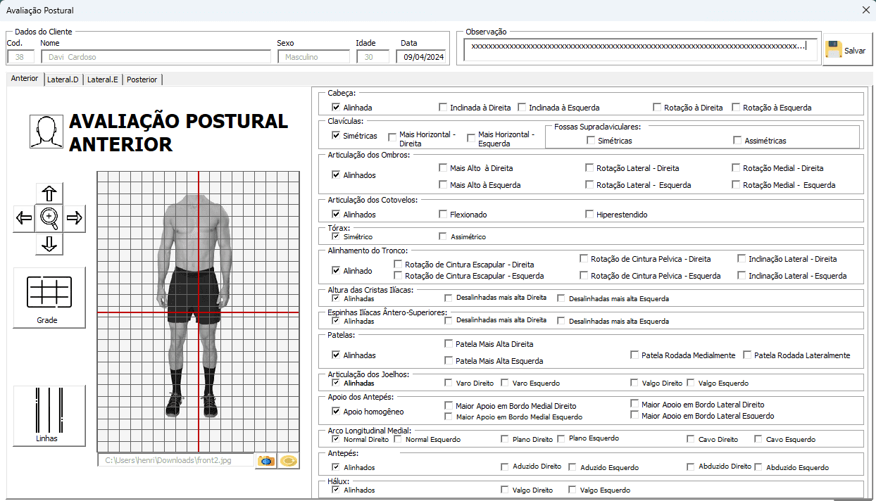 Avaliação Postural pilates planilha