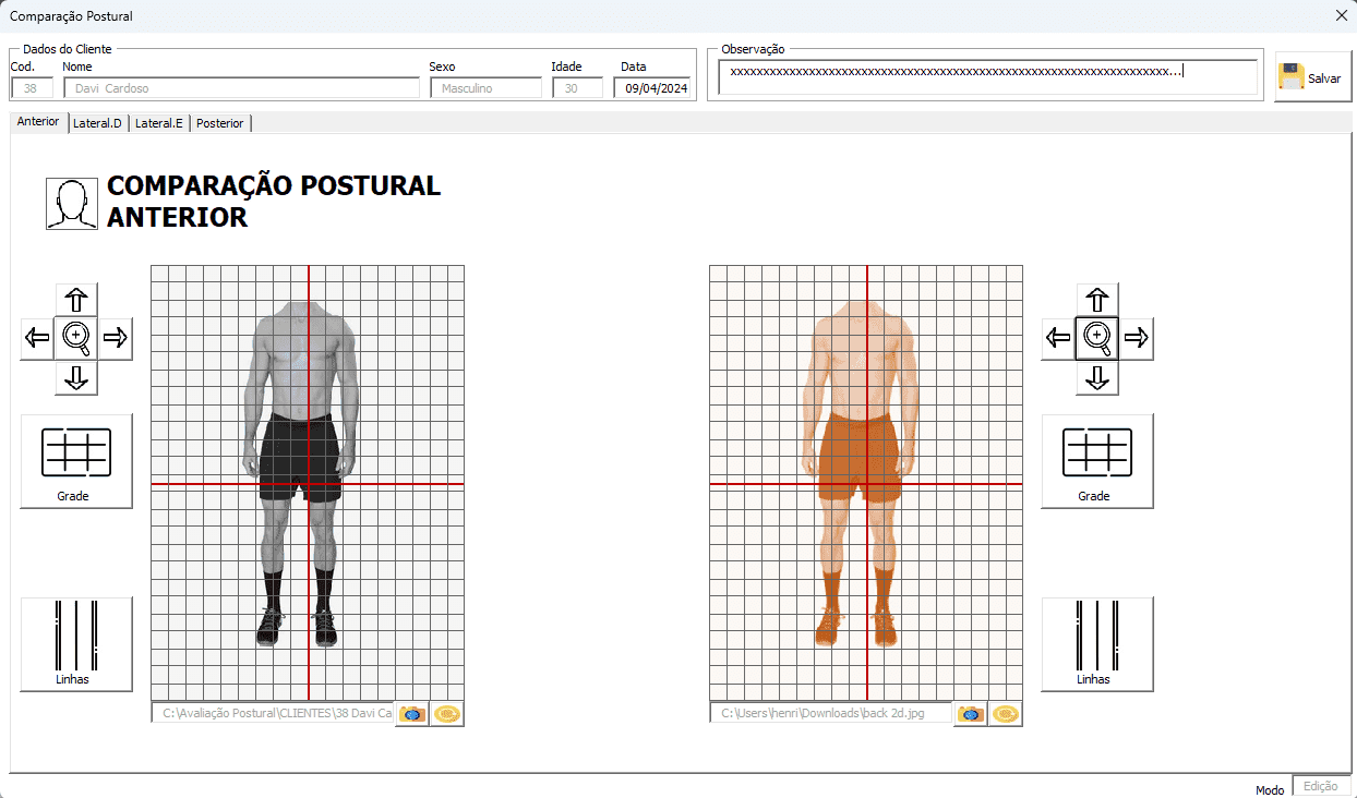 Planilha Comparação Postural