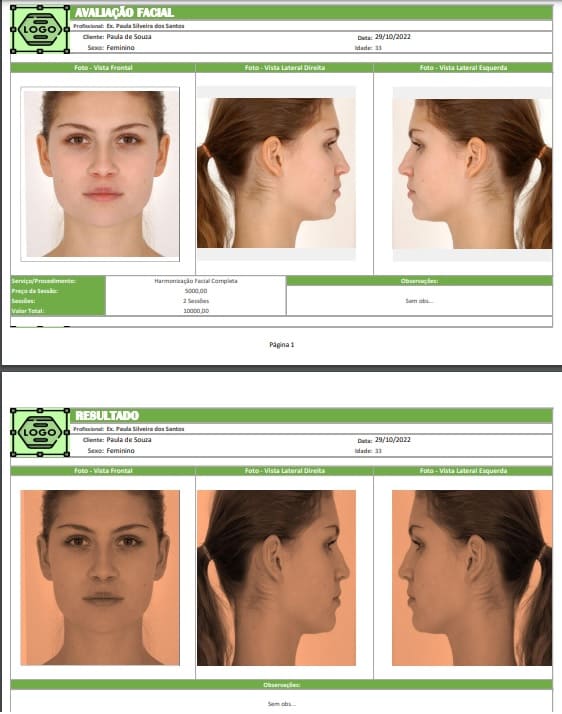 Relatorio harmonização facial